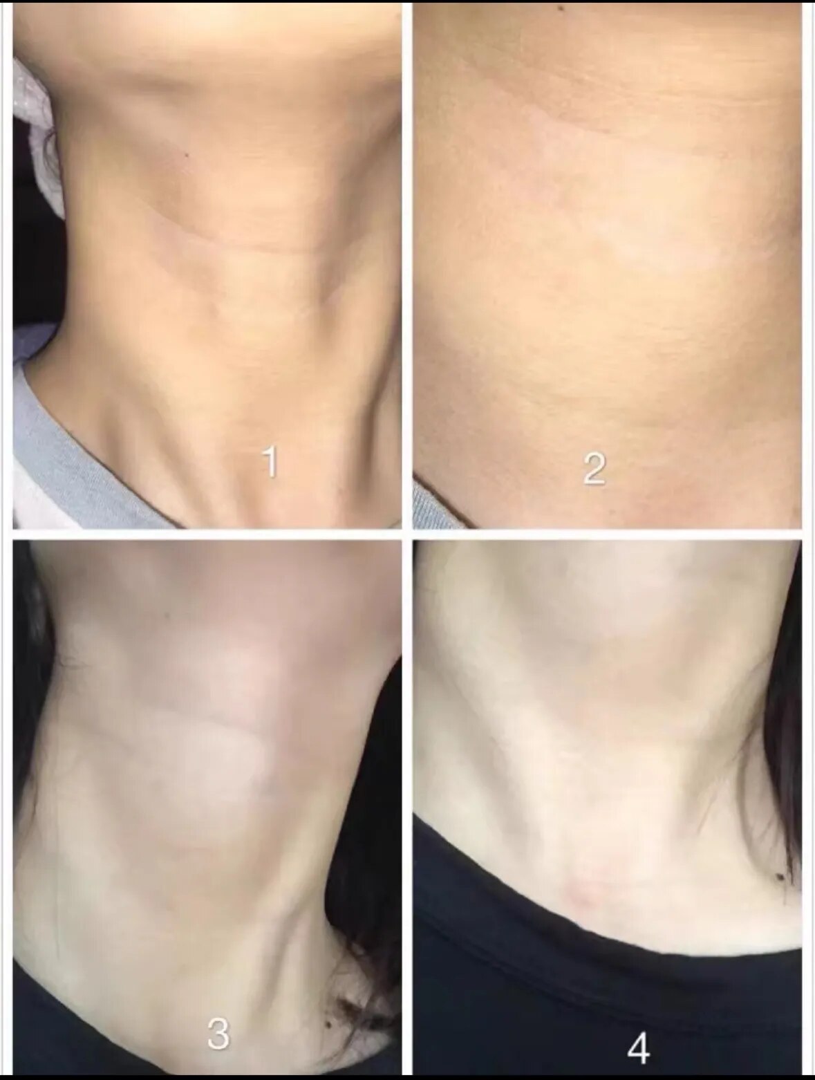 Hydrolyzed Collagen Anti-wrinkle Cream