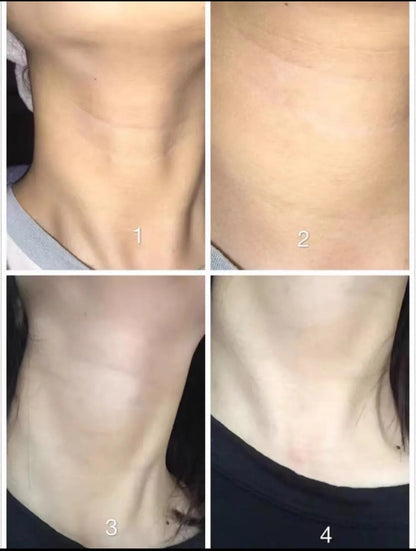 Hydrolyzed Collagen Anti-wrinkle Cream